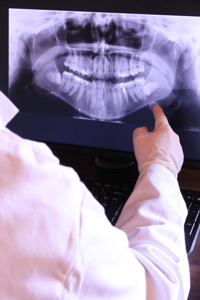 Best Emergency Broken Tooth Repair in Geneva, IL
