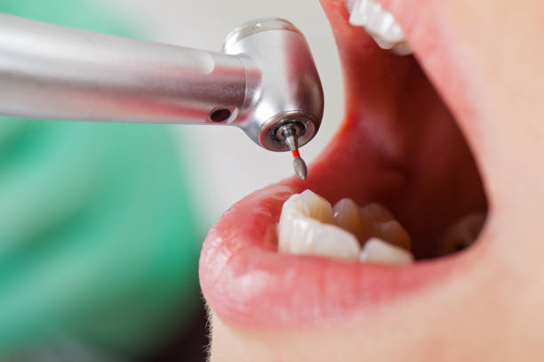 Best Emergency Treatment for Toothache in Geneva, IL
